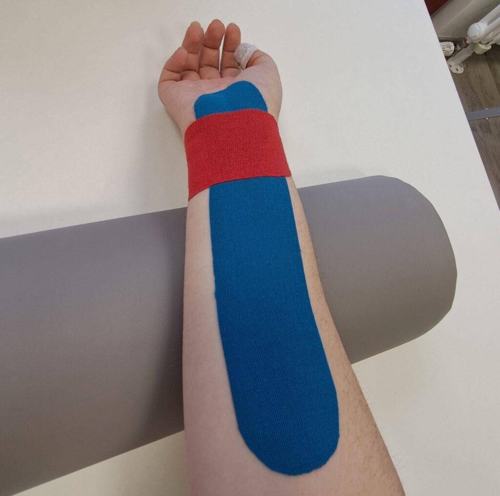 Kinesiologisches Tape am Arm