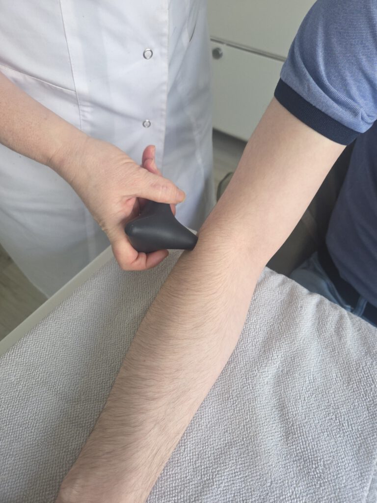 Triggerpunktverwendung